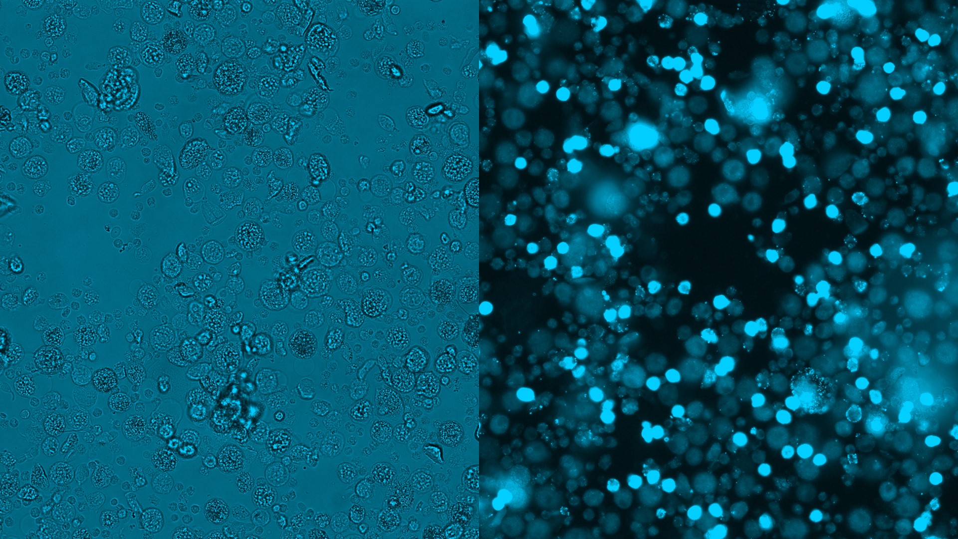 Zellpopulationen innerhalb einer Sputumprobe, z. B. Makrophagen und Granulozyten, unterscheiden sich morphologisch und biologisch voneinander. Die Chipzytometrie ermöglicht den direkten Vergleich zwischen morphologischem Durchlichtbild und den Fluoreszenzfärbungen auf Einzelzellebene.