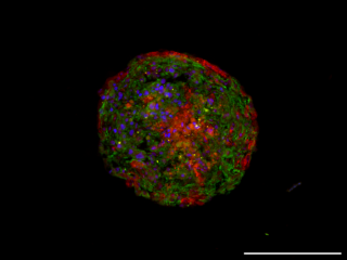 Herzorganoid (ca. 200 µm groß). 