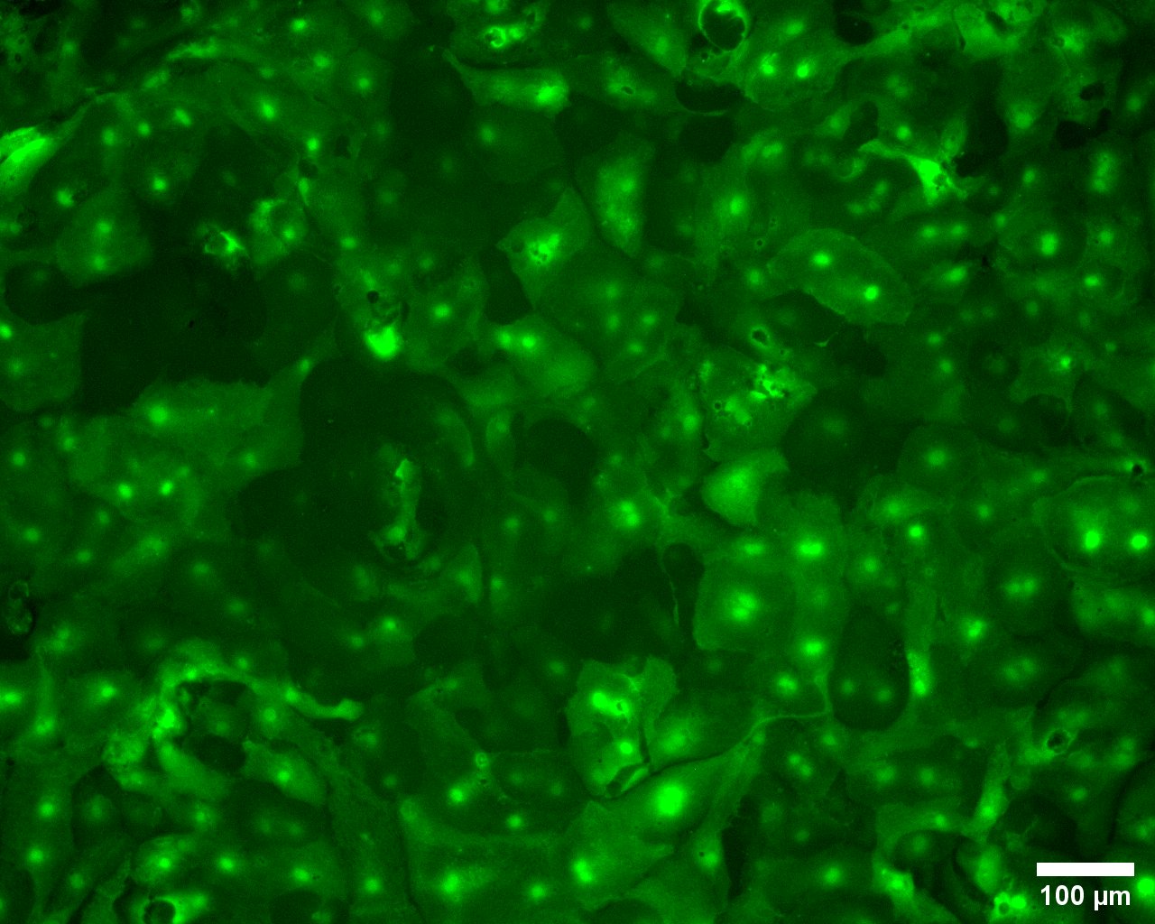 Mikroskopisches Bild von grün fluoreszierenden Zellen.