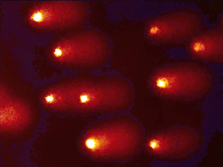 DNA-Kometen im Comet-Assay.