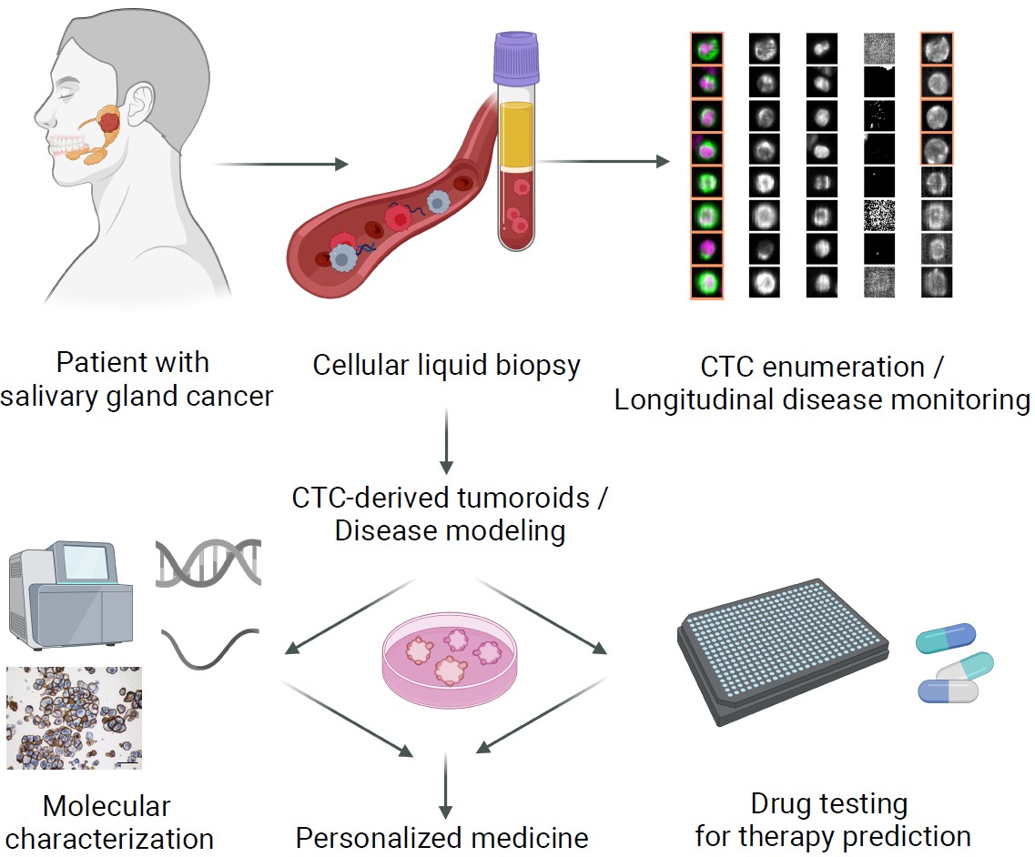 Grafische Darstellung zur Anwendung der Flüssigbiopsie in der personalisierten Medizin für Patientinnen und Patienten mit Speicheldrüsenkrebs (SGC)