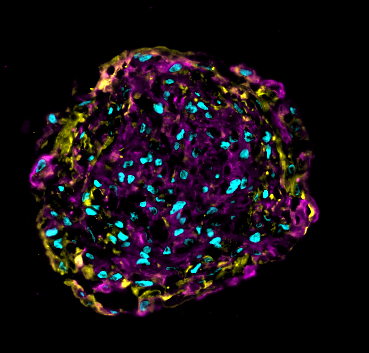 Mikroskopische Aufnahme eines Herzorganoids, verschiedene Zelltypen unterschiedlich gefärbt.