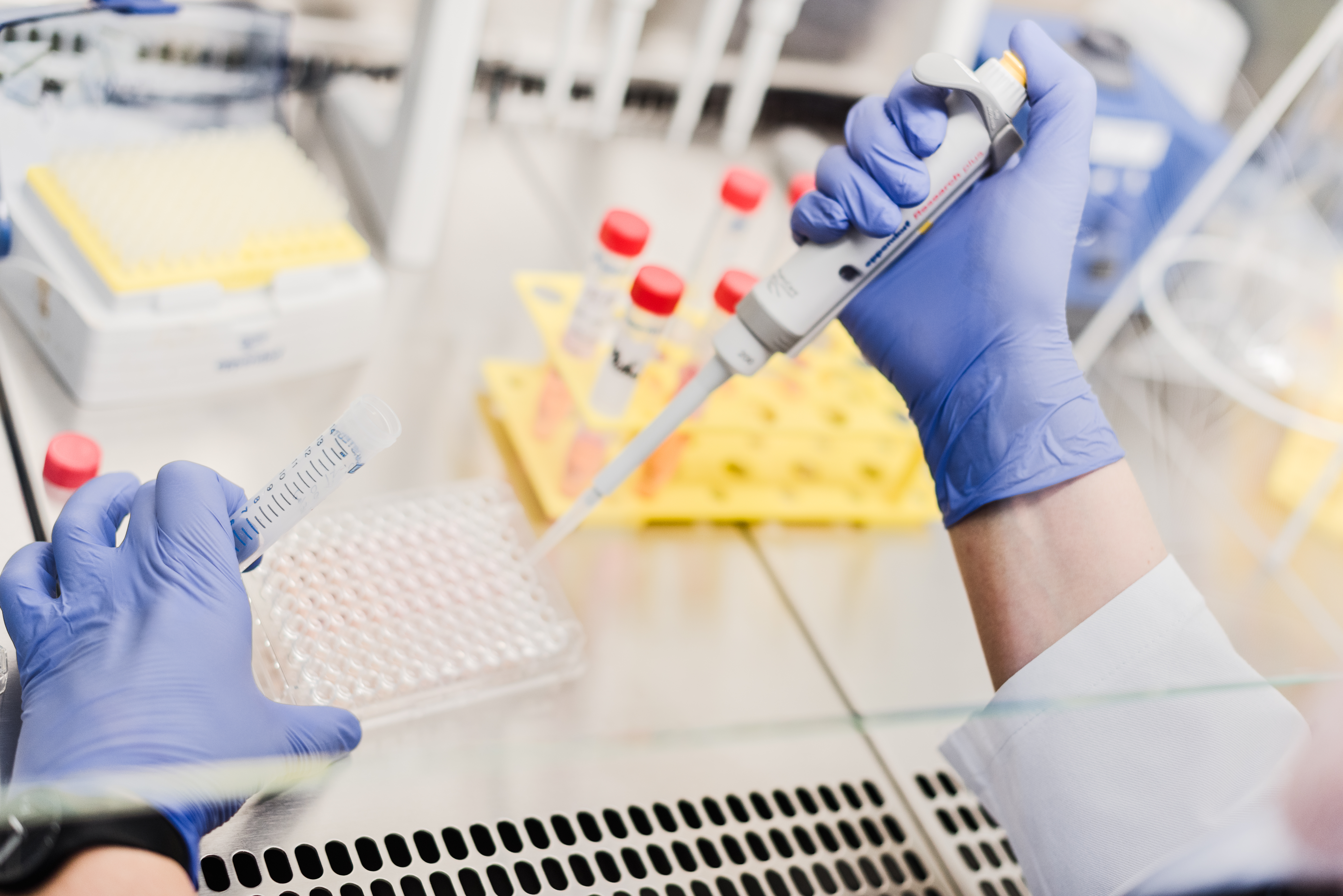 Specific sputum biomarkers