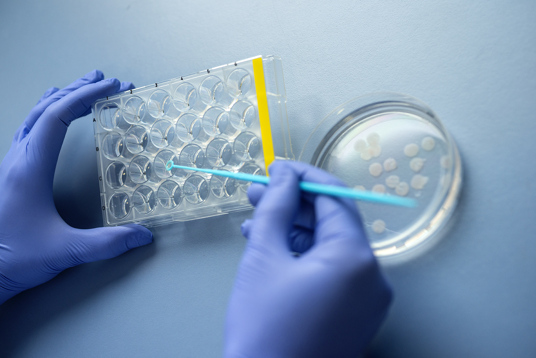 Precision-cut lung slices Precision-cut lung slices