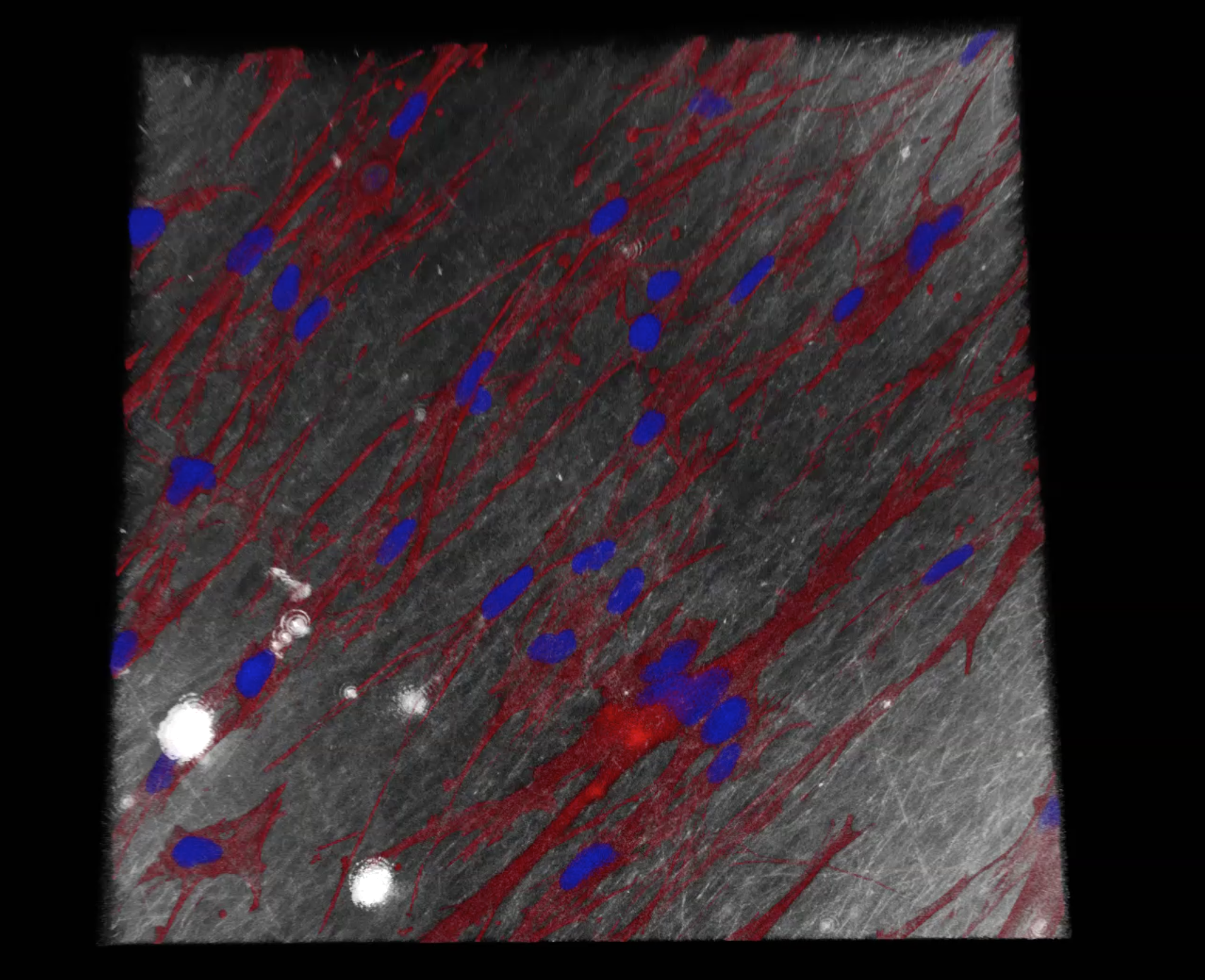 Fibroblasts (connec-tive tissue cells) on the elec-trospun Renacer® membrane under the confocal micro-scope (red: cytoskeleton of the cells, blue: cell nuclei). 