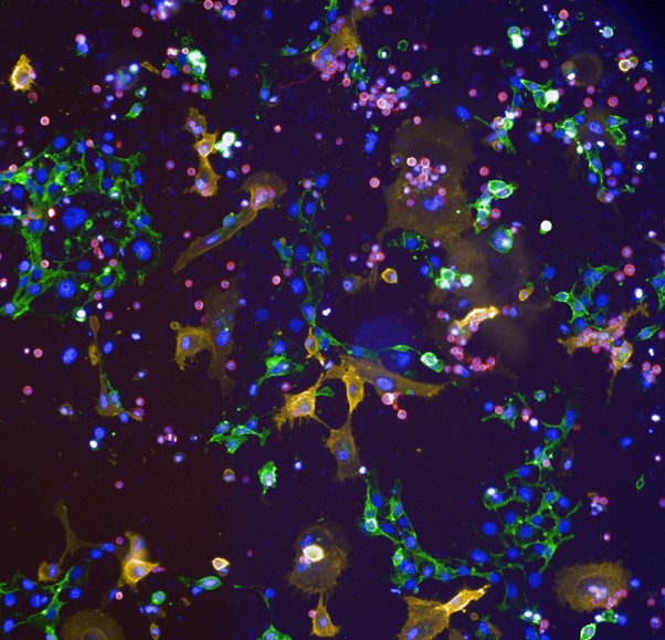 Microscopic image of different cell types displayed in various colors.