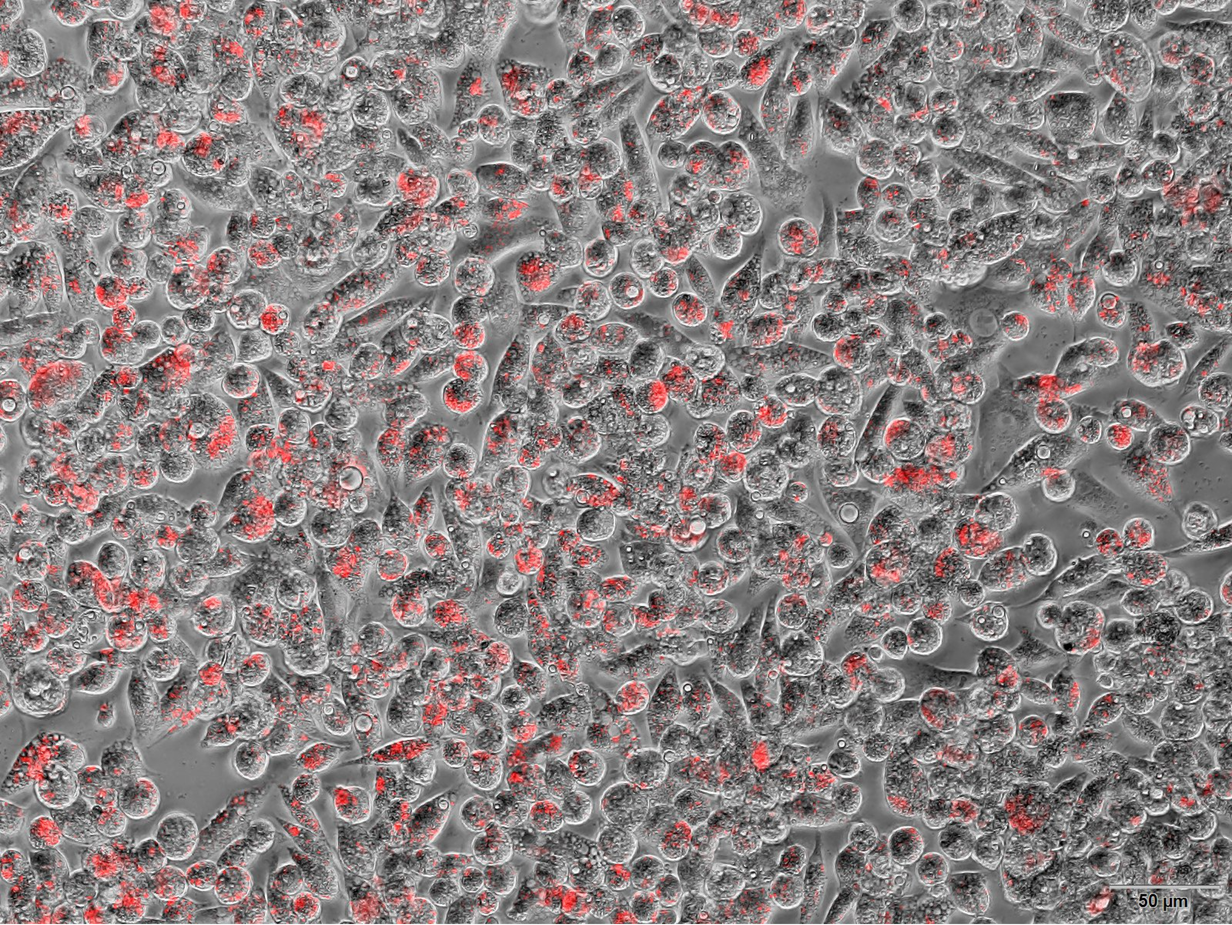Macrophages fighting bacteria.