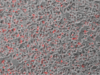 Macrophages fighting bacteria.