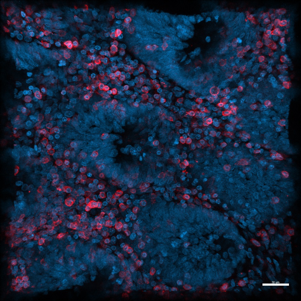 Intestinal tissue section.