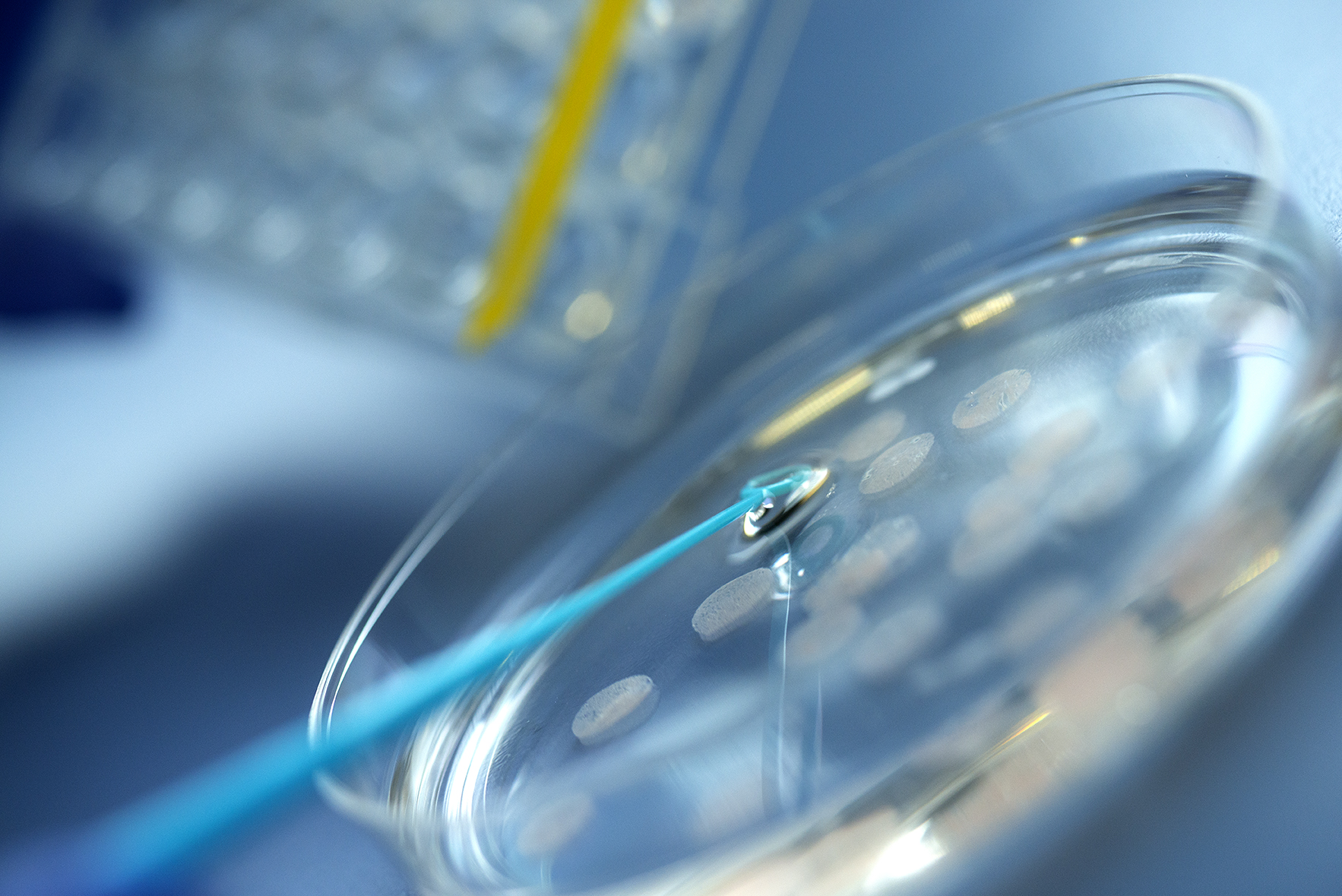 Precision lung slices are lifted from a petri dish using an inoculation loop.