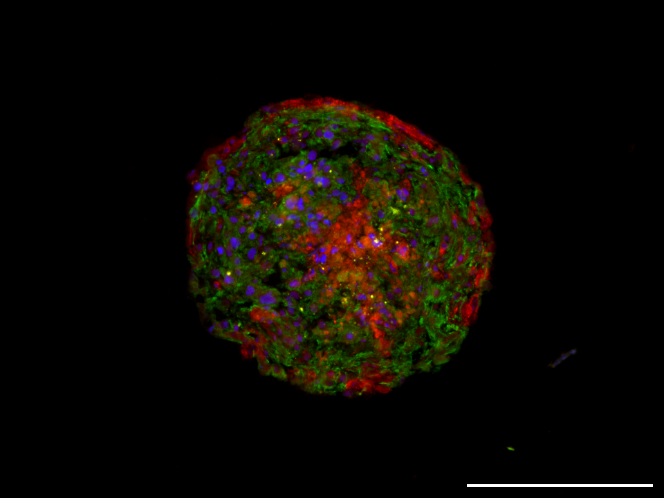 Heart organoid (approx. 200 µm in size).