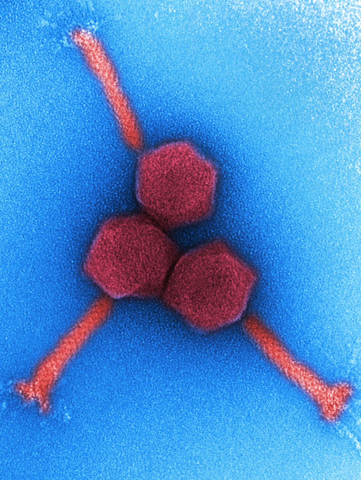 PhagoFlow Electron microscope image of bacteriophages.