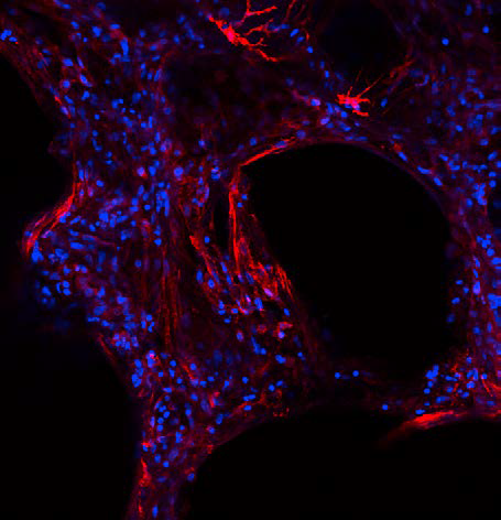 Microscopic image of a lung tissue section with blue and red fluorescent cells.