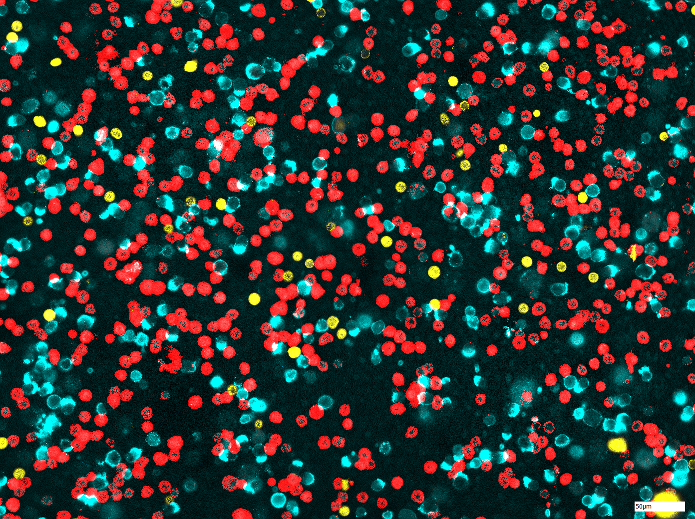 Microscopic image of differently stained cells.