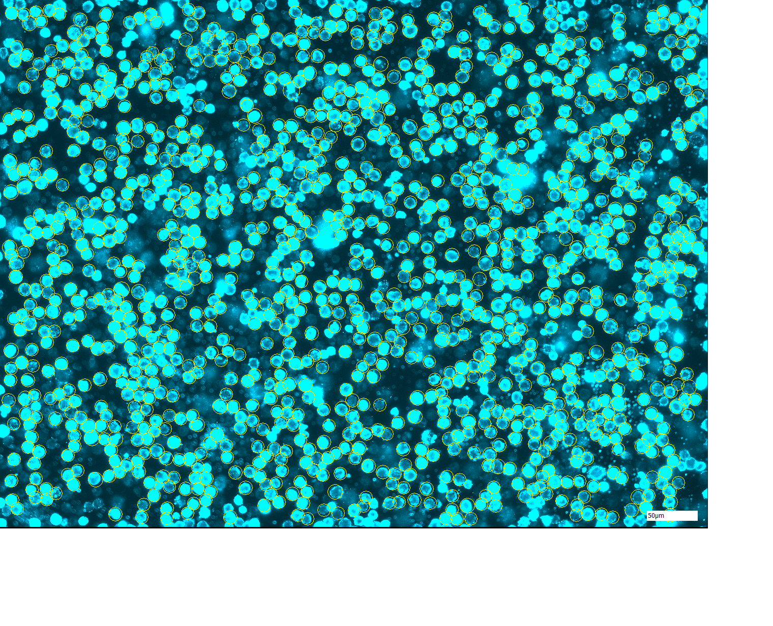 Microscopic image of turquoise glowing cells.