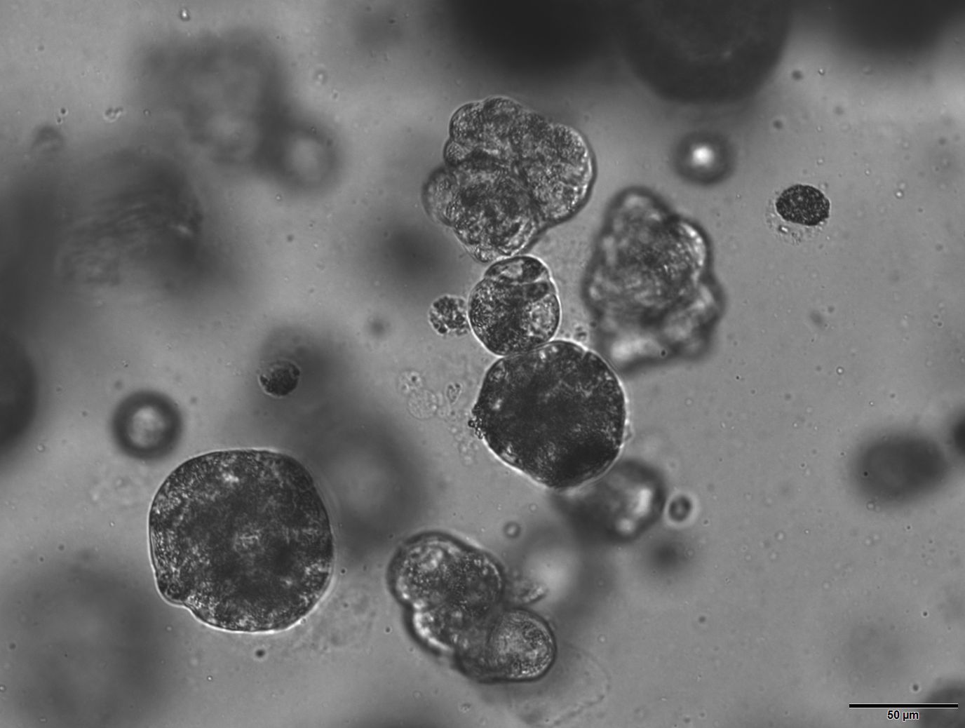 3D tumoroid cultures