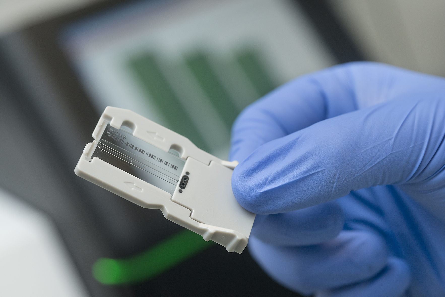 Biomarkers for early diagnosis of Alzheimer's disease.