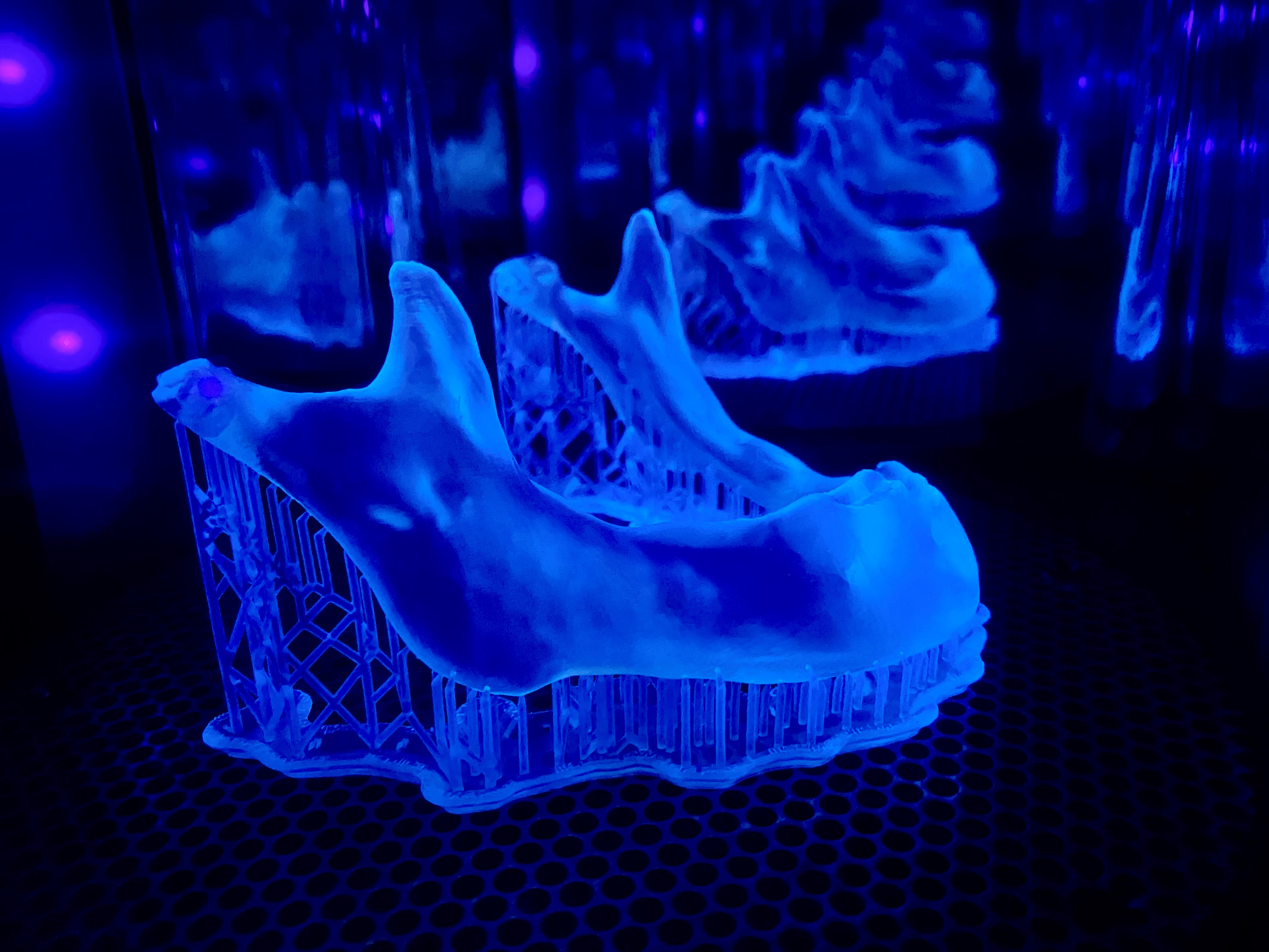 Patientenspezifisches Implantate 3D-Druck Kiefer