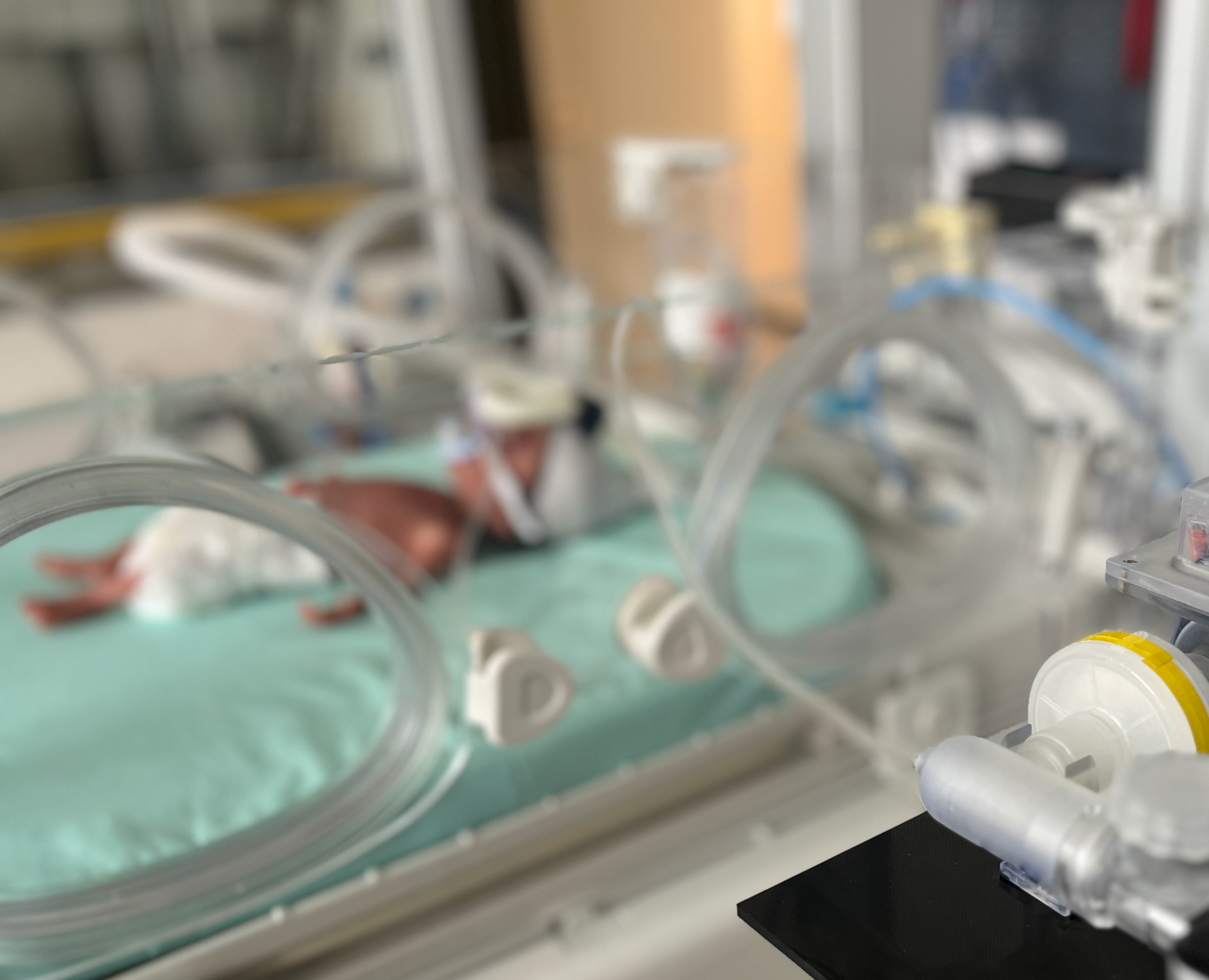 The “Inhale+” technology patented at Fraunhofer ITEM is designed to help premature babies with severe respiratory distress syndrome. Die am Fraunhofer ITEM patentierte Technologie »Inhale+« soll Frühgeborenen mit einem schweren Atemnotsyndrom helfen.