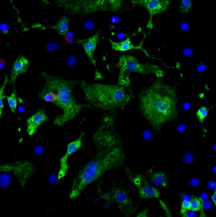 Microscopic image of cardiac muscle cells stained green and blue.