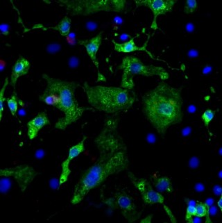 Microscopic image of cardiac muscle cells stained green and blue.