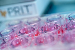 Cell culture plate with inserts.
