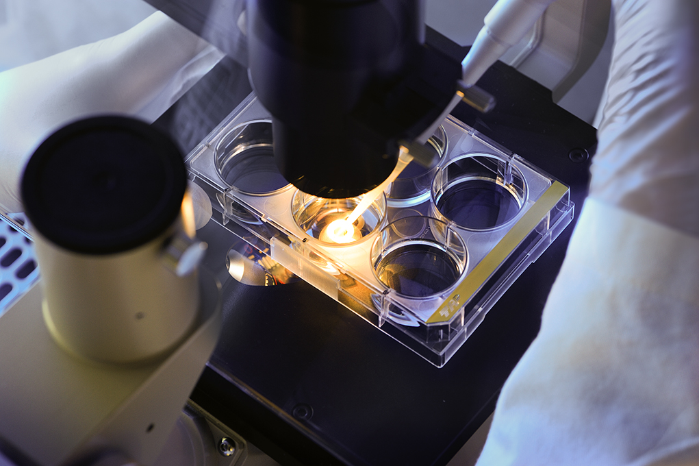Development of mammalian and microbial produktion cell lines