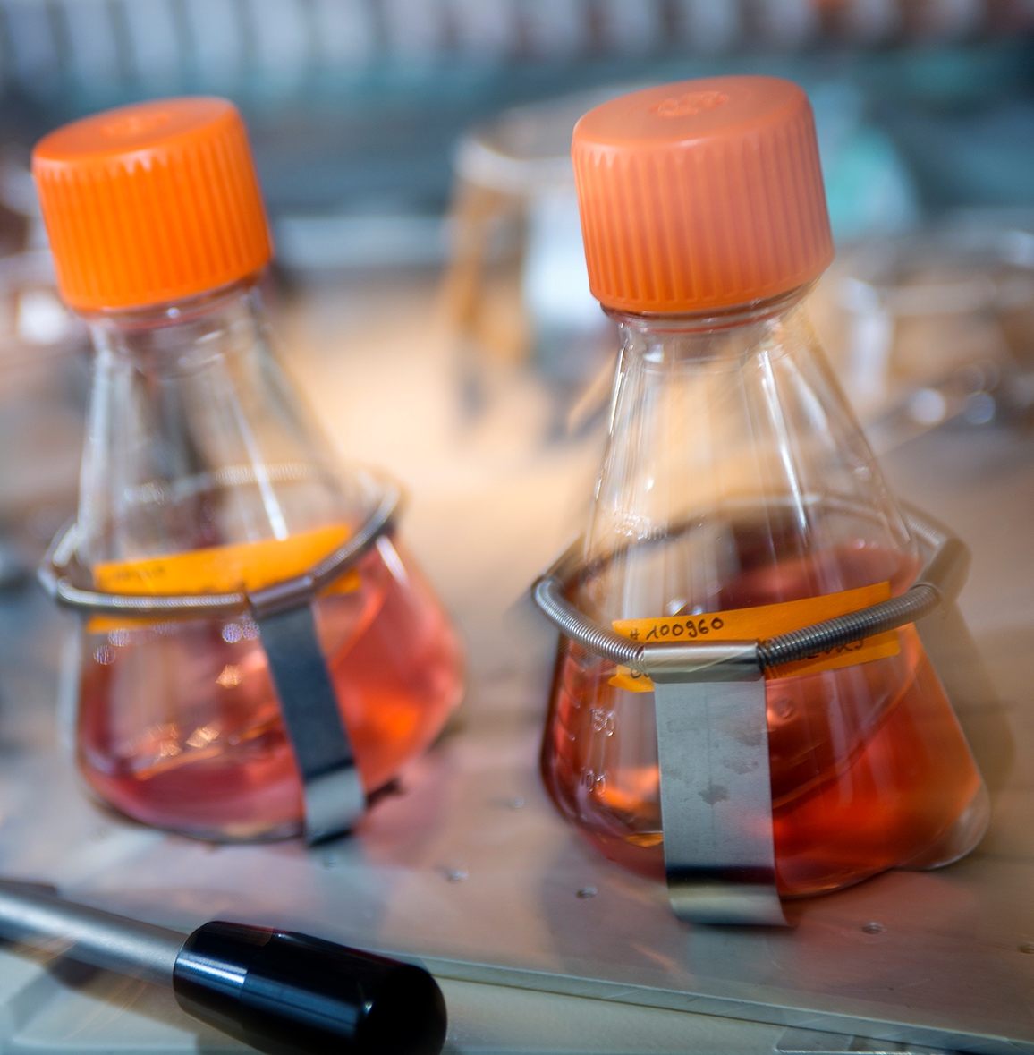 Microbial expression systems